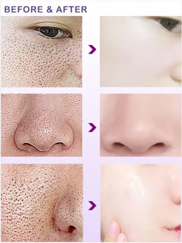 Soro Facial Iluminador com Retinol e Niacinamida, Refinação e Resurfacing do Poro, Textura da pele - Image 3