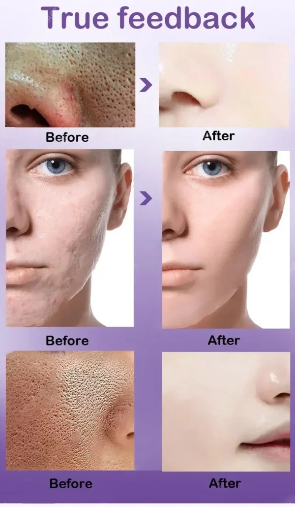 Soro Facial Iluminador com Retinol e Niacinamida, Refinação e Resurfacing do Poro, Textura da pele - Image 5