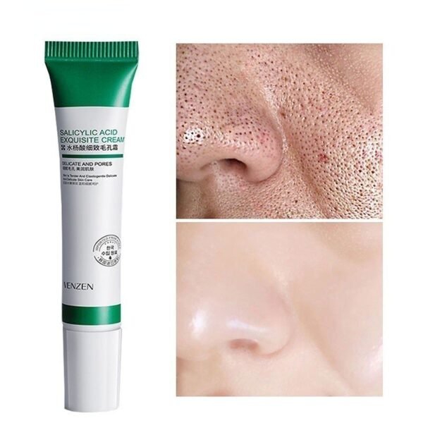 20ml Creme De Ácido Salílico Para Remoção De Poros/Acne E Clareador/Clareamento/Controle De Oleosidade /