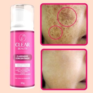Clareador de manchas na pele rosto virilha axila e partes intimas - clear beauty